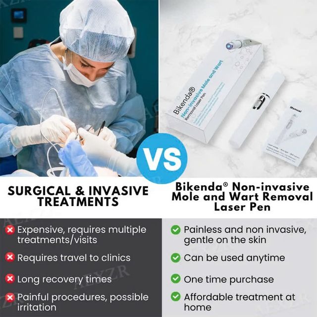 Non-Invasive Mole and Wart Removal Laser Pen